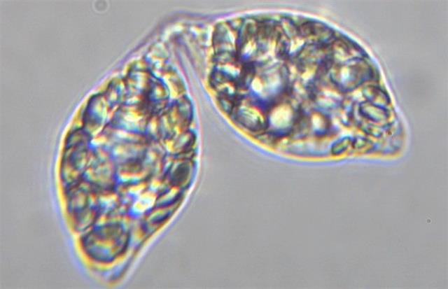 Thức ăn tôm thẻ: Sự khác biệt của Beta-glucan từ tảo Thức ăn tôm thẻ: Sự khác biệt của Beta-glucan từ tảo
